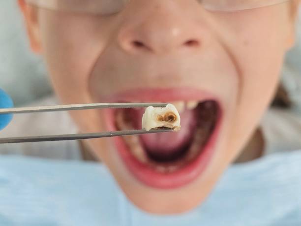 Best Tooth Pain Emergency Relief  in Sylvania, OH